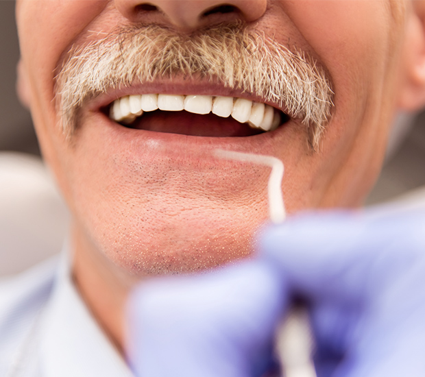 Wilmington Adjusting to New Dentures