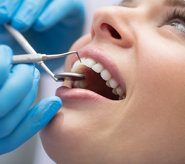 Wilmington Dental Bonding