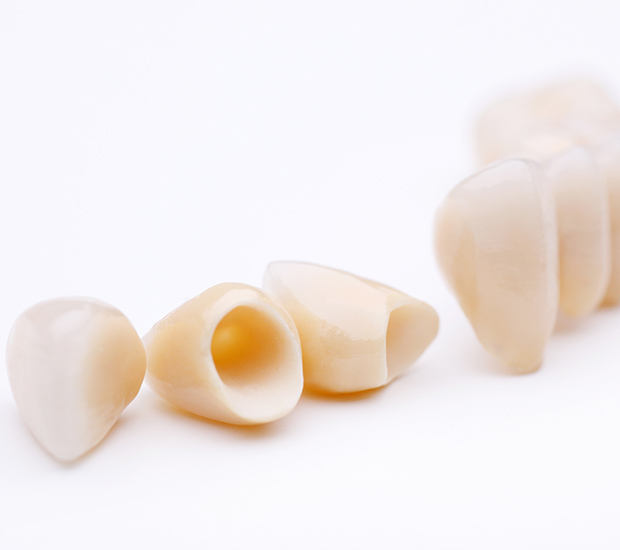 Wilmington Dental Crowns and Dental Bridges