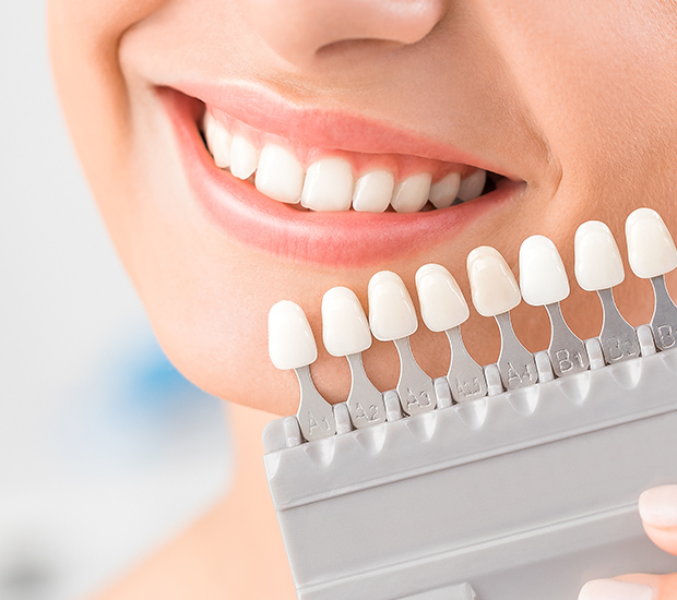 Wilmington Dental Veneers and Dental Laminates