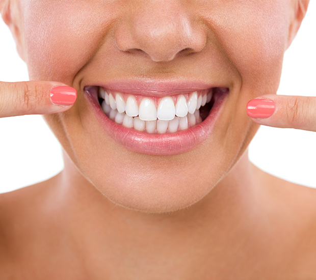 Wilmington What Is Gum Contouring & Reshaping