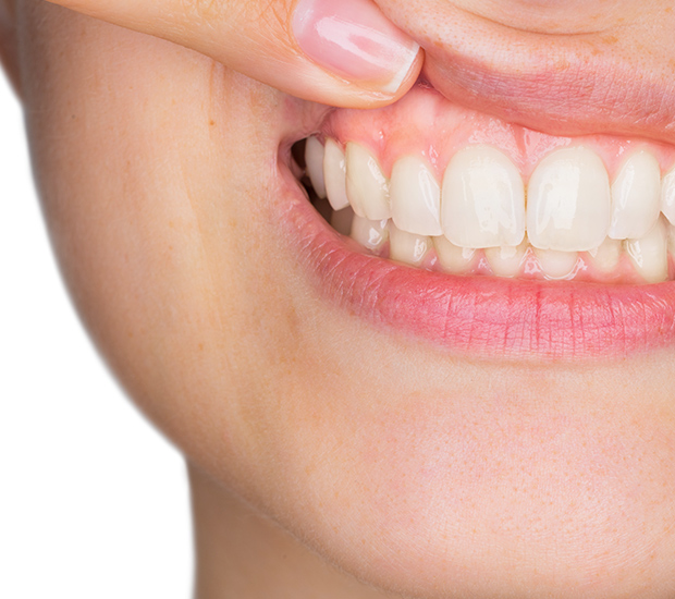Wilmington Gum Disease